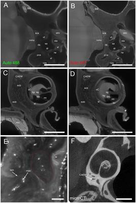 Temporal bone marrow of the rat and its connections to the inner ear